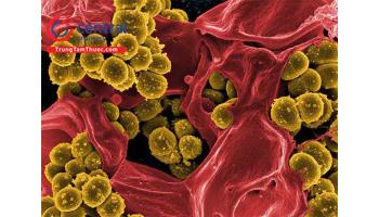 Điều trị và dự phòng nhiễm trùng do tụ cầu vàng Staphylococcus