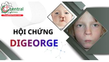 Hội chứng DiGeorge là gì, có di truyền không? Nguyên nhân, triệu chứng và cách điều trị
