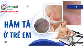 Hăm tã là gì? Nguyên nhân do đâu và cách phòng ngừa bố mẹ nên biết