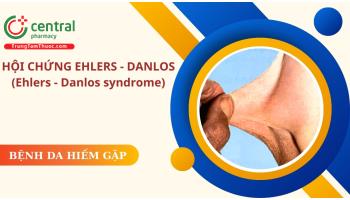 Hội chứng Ehlers - Danlos (Ehlers - Danlos syndrome): dịch tễ, biểu hiện, cách chẩn đoán