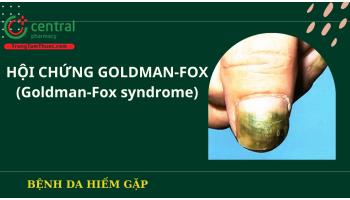 Nguyên nhân và cách điều trị Hội chứng Goldman-Fox (Goldman-Fox syndrome)