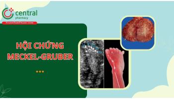 Hội chứng Meckel-Gruber: bệnh học, biểu hiện lâm sàng và cách chẩn đoán