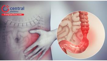 Hội chứng ruột kích thích: nguyên nhân và cách điều trị