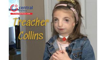 Hội chứng Treacher Collins: Nguyên nhân, Triệu chứng và Điều trị