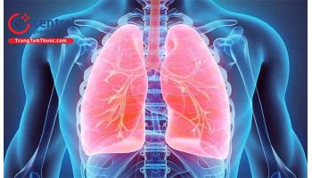 Hướng dẫn chẩn đoán và điều trị viêm phổi không đáp ứng điều trị