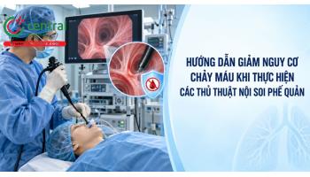 Hướng dẫn giảm nguy cơ chảy máu khi thực hiện các thủ thuật nội soi phế quản