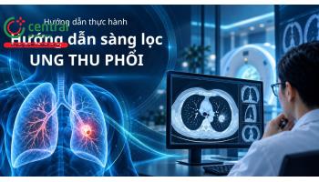 Hướng dẫn thực hành lâm sàng - Sàng lọc ung thư phổi
