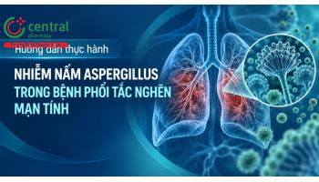Hướng dẫn thực hành: Nhiễm nấm Aspergillus trong bệnh phổi tắc nghẽn mạn tính