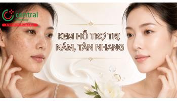 Gợi ý 6 kem mờ nám hiệu quả cao, an toàn được nhiều chị em săn đón