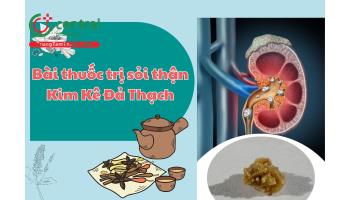 Bài thuốc trị sỏi thận Kim Kê Đả Thạch
