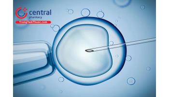 Kỹ thuật trích tinh trùng - Giải pháp cho bệnh nhân vô sinh
