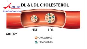Rối loạn lipid máu: đánh giá rối loạn lipid máu và mức độ nguy hiểm