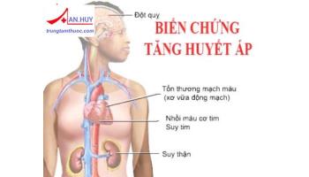 Các dấu hiệu cảnh báo biến cố tim mạch