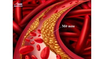 Sản phẩm giành cho người mỡ máu cao tốt nhất hiện nay