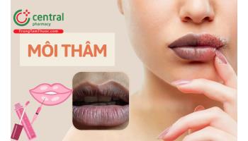 Môi thâm là cảnh báo bệnh gì? Cách trị môi hết thâm chỉ trong 1 tuần