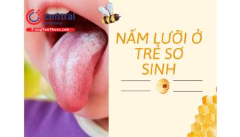 Nấm lưỡi ở trẻ sơ sinh - Nguyên nhân, dấu hiệu, phương pháp điều trị