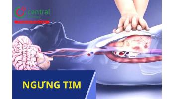 Hỗ trợ sự sống cơ bản và nâng cao trong hồi sức sau ngưng tim