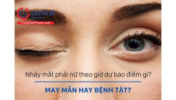 Nháy mắt phải nữ theo giờ dự báo điềm gì? Xui xẻo hay bệnh tật?