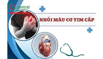 Nhồi máu cơ tim cấp: Triệu chứng và phác đồ điều trị  
