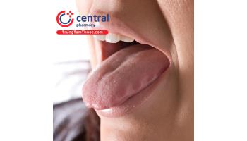 Những thông tin cần biết về bệnh của lưỡi và miệng