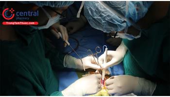 Phẫu thuật cắt trĩ: Các phương pháp điều trị và những điều cần biết