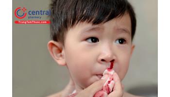 Phương pháp điều trị bệnh Hemophilia - bệnh ưa chảy máu ở trẻ em
