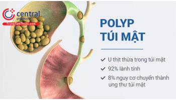 Polyp túi mật: yếu tố nguy cơ, triệu chứng và cách điều trị