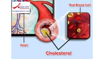 NGUYÊN NHÂN, TRIỆU CHỨNG, ĐIỀU TRỊ RỐI LOẠN LIPID MÁU