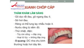Bệnh viêm răng quanh chóp cấp: chẩn đoán và điều trị