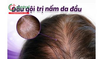REVIEW 5 loại dầu gội trị nấm hiệu quả được chuyên gia khuyên dùng