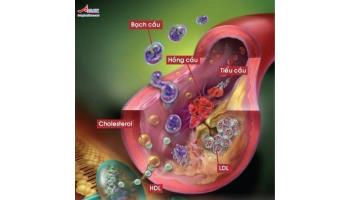 Bệnh rối loạn lipid máu: dấu hiệu, nguyên nhân và điều trị