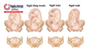 Nguyên nhân và các biện pháp can thiệp trường hợp khó sinh ở sản phụ