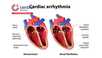 Dược lý các nhóm thuốc điều trị rối loạn nhịp tim