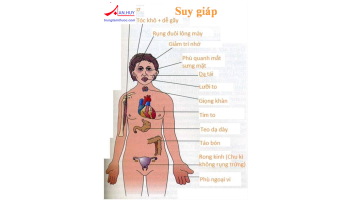 NGUYÊN NHÂN, TRIỆU CHỨNG VÀ ĐIỀU TRỊ SUY GIÁP Ở NGƯỜI LỚN