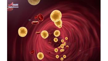 Nhóm thuốc hạ lipid máu: đại cương và thuốc cụ thể