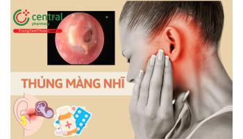 Thủng màng nhĩ có điếc không? Có tự liền được không? Dấu hiệu và cách chữa tại nhà