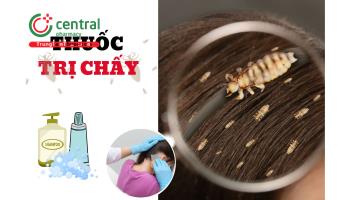 Thuốc trị chấy, diệt trứng chấy được các chuyên gia khuyên dùng