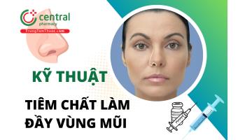 Chi tiết kỹ thuật tiêm chất làm đầy vùng mũi trong phẫu thuật thẩm mỹ