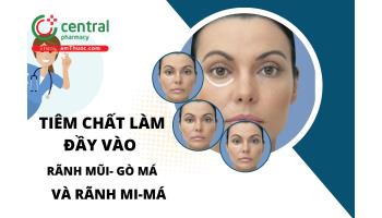 Kỹ thuật tiêm chất làm đầy vào rãnh mũi- gò má và rãnh mi-má