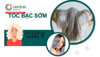 Tóc bạc sớm có sao không? Nguyên nhân và cách khắc phục hiệu quả 