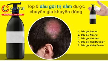 REVIEW 6 loại thuốc và dầu gội trị gàu, nấm da đầu hiệu quả