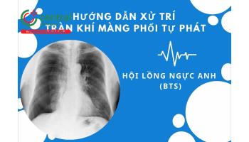 Hướng dẫn xử trí tràn khí màng phổi tự phát của hội lồng ngực Anh  