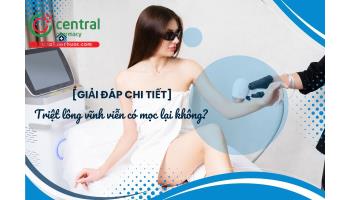 [Giải đáp chi tiết] Triệt lông vĩnh viễn có mọc lại không?