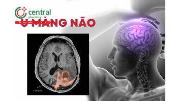 U màng não có nên mổ không? Triệu chứng và phương pháp chẩn đoán bệnh