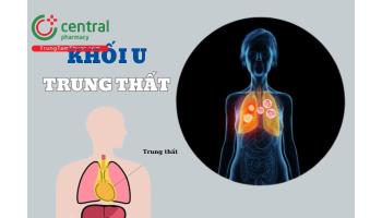 U trung thất ác tính sống được bao lâu? Triệu chứng và phương pháp điều trị