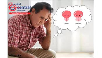 U xơ tiền liệt tuyến: Căn bệnh gây khó chịu của đàn ông trung niên