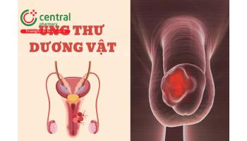 Ung thư dương vật có chết không? Hình ảnh và triệu chứng nhận biết giai đoạn đầu