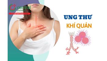 Ung thư khí quản là gì? Sống được bao lâu? Nguyên nhân và triệu chứng bệnh