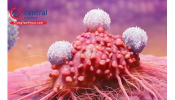 Ung thư không rõ nguồn gốc: Chẩn đoán và cách điều trị