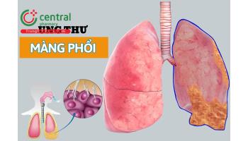 Ung thư màng phổi có nguy hiểm không? Nguyên nhân và cách điều trị